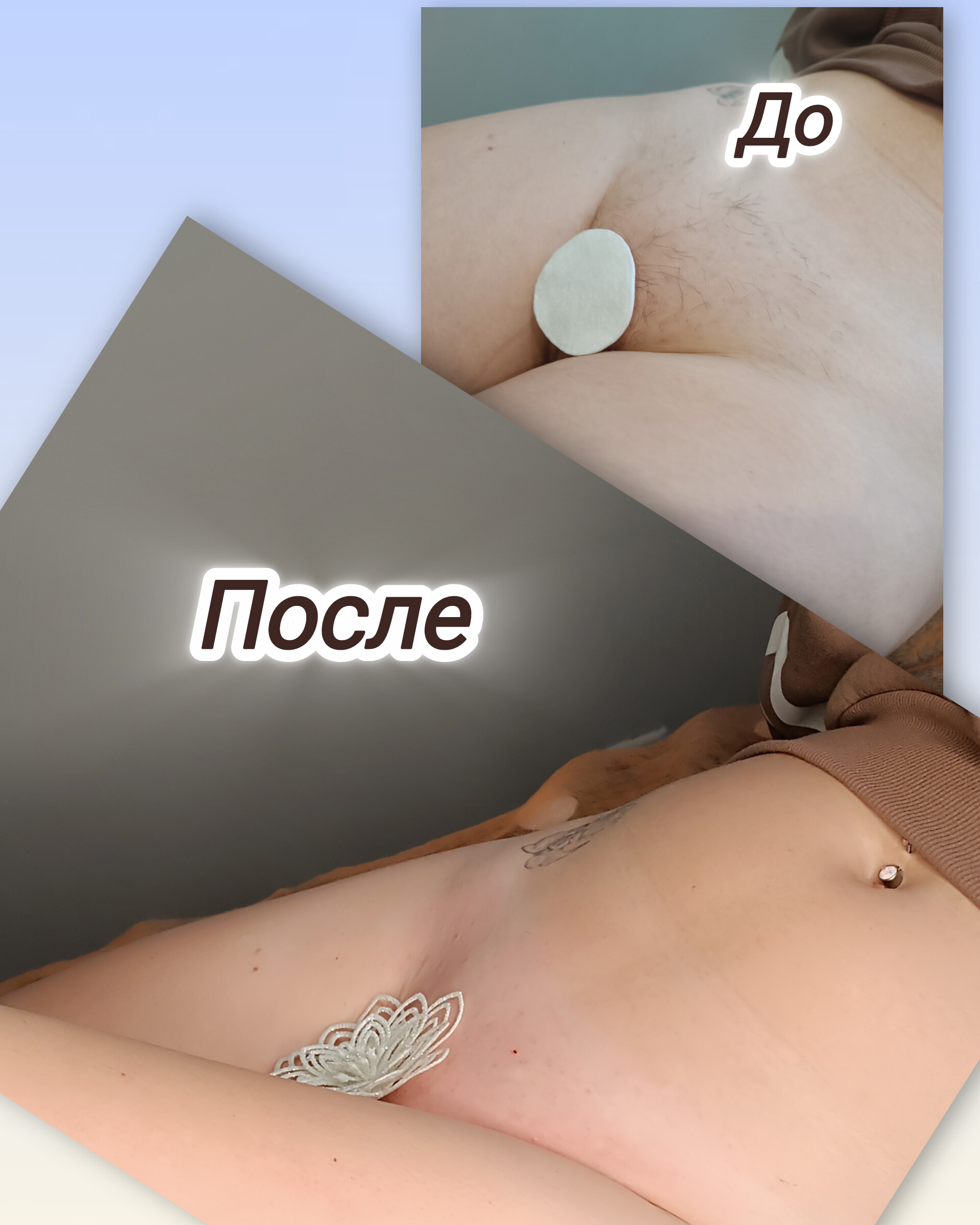 Шугарінг бікіні